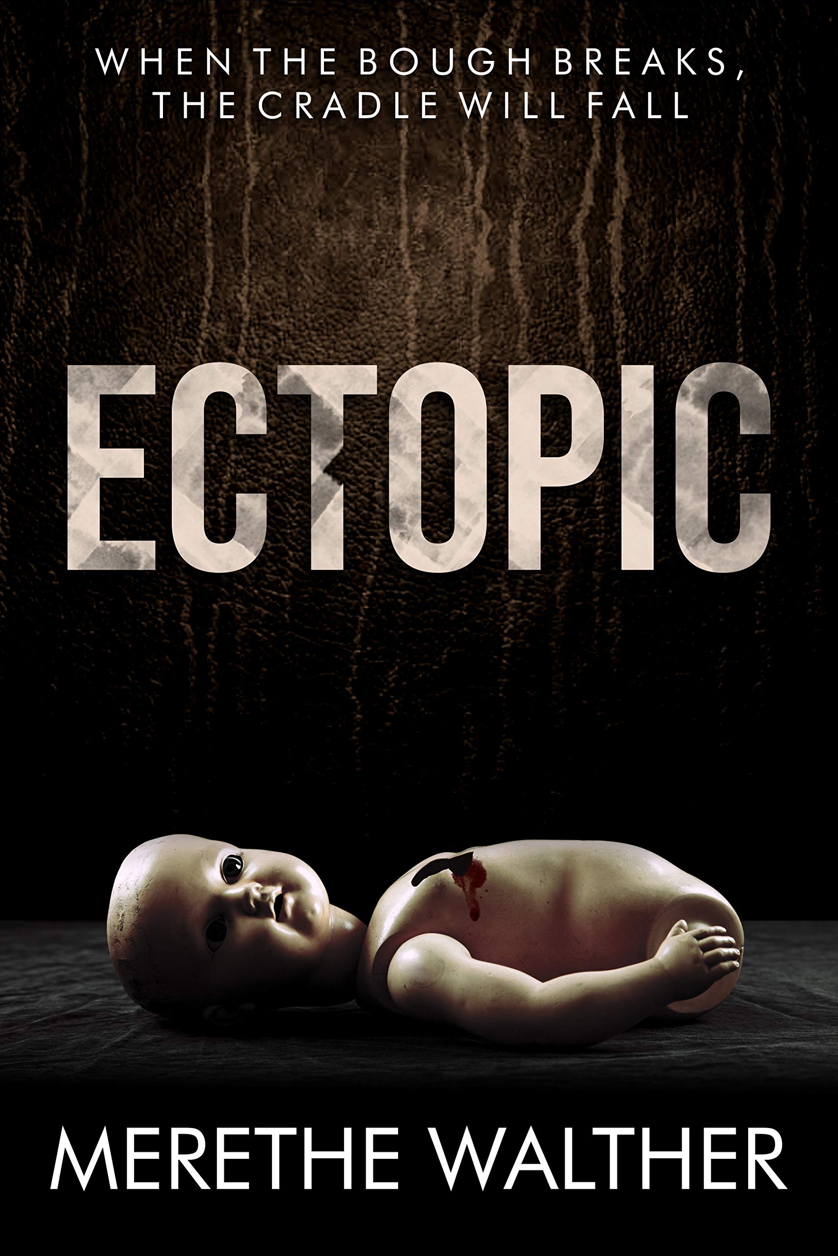 Ectopic